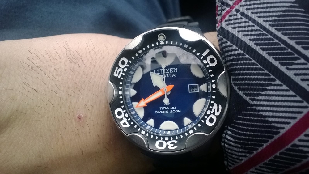 TB9Lx3n.jpg