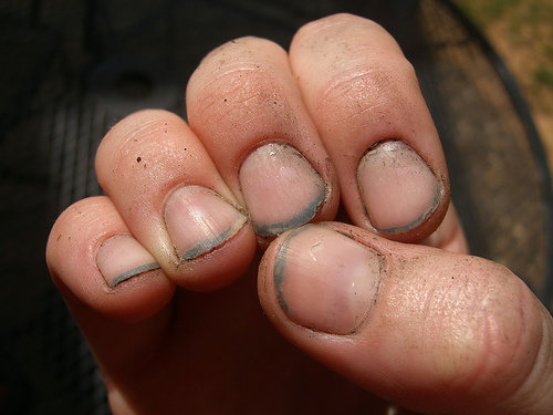 dirty+nails.jpg