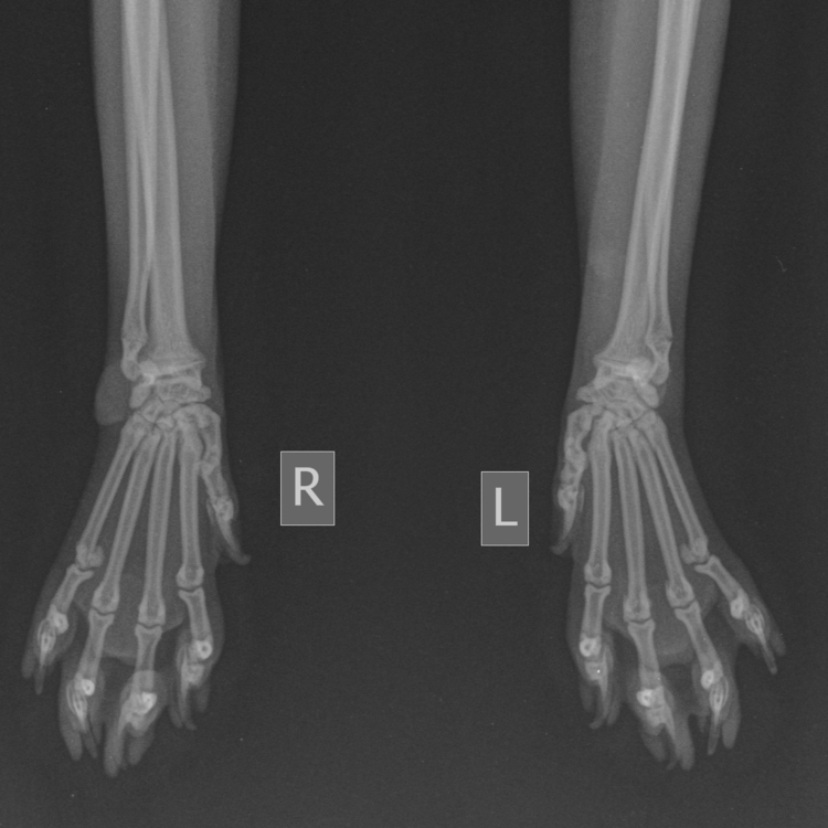 Małe - Szkielet _ 10 kg-Nadgarstek AP-2023-05-12-17_46_44-685.jpg